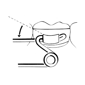 Unitek Lingual Sheat .036x.072 Universal Curved rod 10EA  