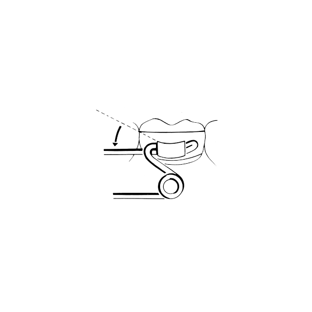 Unitek Lingual Sheat .036x.072 Universal Curved rod 10EA  