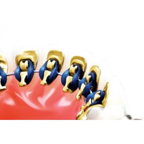 Unitek AlastiK Lingual Ligatures NavyBlue 144EA  