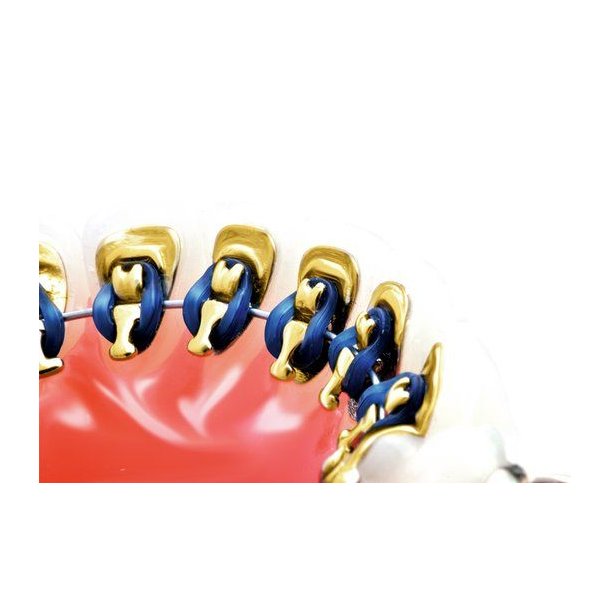 Unitek AlastiK Lingual Ligatures NavyBlue 144EA  