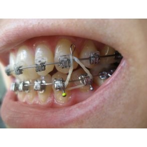 BD Drop-In Hooks 30EA   