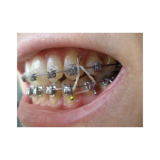 BD Drop-In Hooks 30EA   