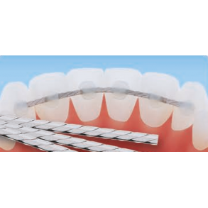 OA Braided Retainer Wire .010x.029 10EA  